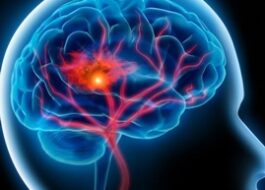 ⁨درمان اورژانسی ادم مغز