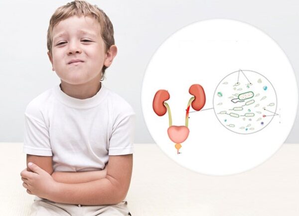 عفونت ادراری